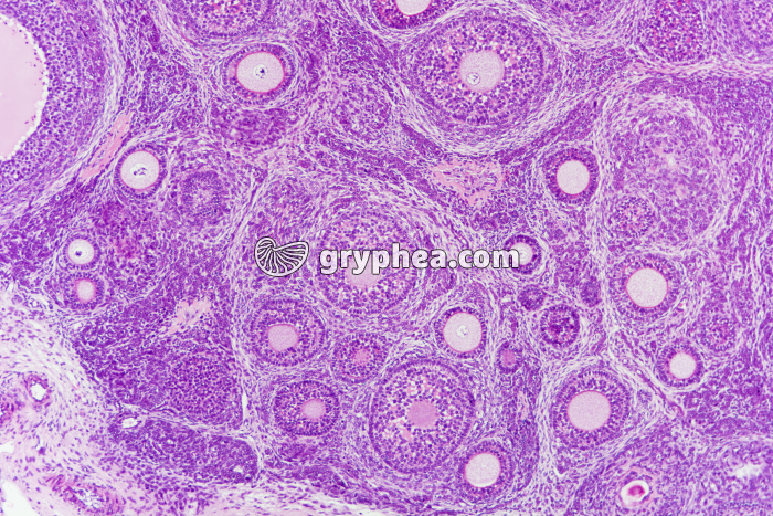 Ovaire de Lapine - follicules primaires x25 - gryphea.com